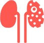 Kidney Cancer