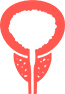 Prostate Cancer